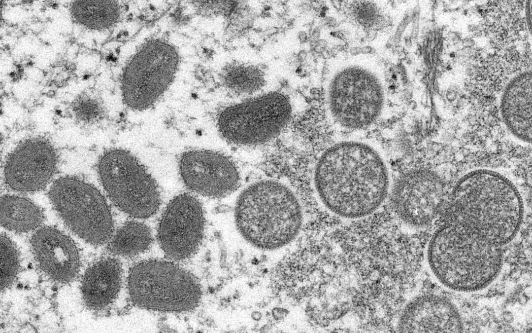WHO considers declaring monkeypox a global health emergency