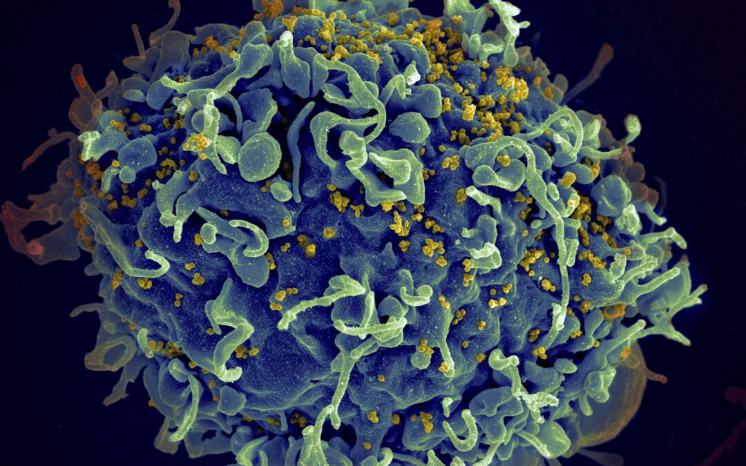 Global AIDS fight at crossroads after setbacks during COVID