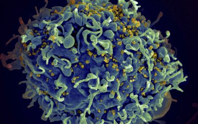 Global AIDS fight at crossroads after setbacks during COVID