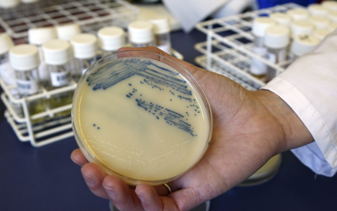 Superbug infections, deaths rose at beginning of pandemic