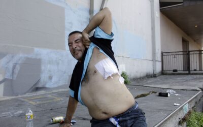 Gunshot injuries surged in US during pandemic, CDC says