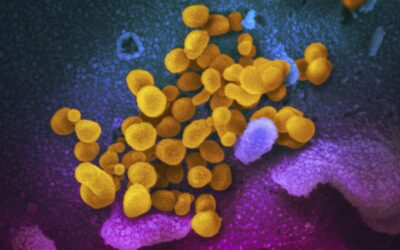 US study finds 1 in 10 get long COVID after omicron, starts identifying key symptoms